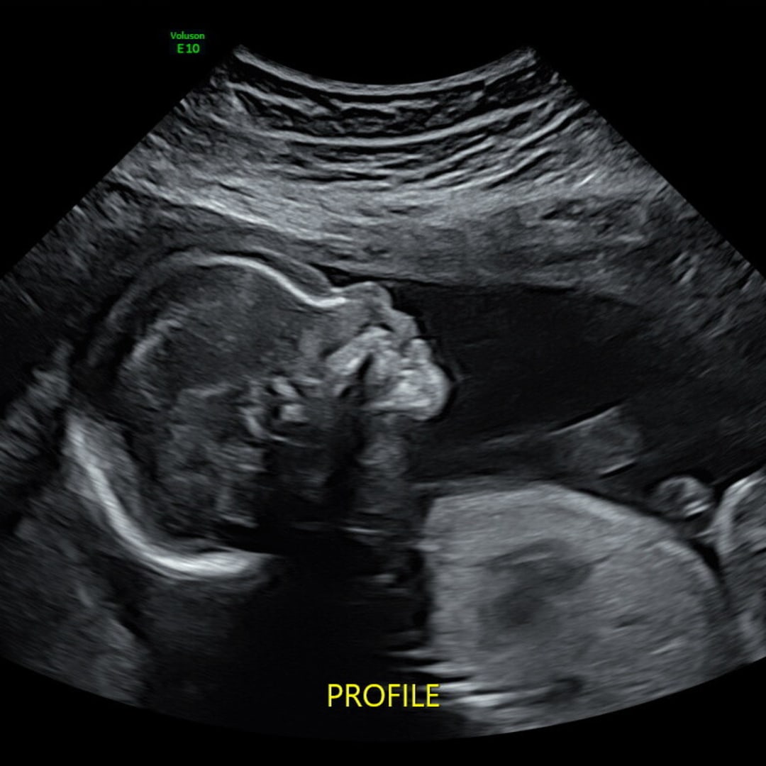 Photo shared by Elizabeth for their Babylist baby registry.