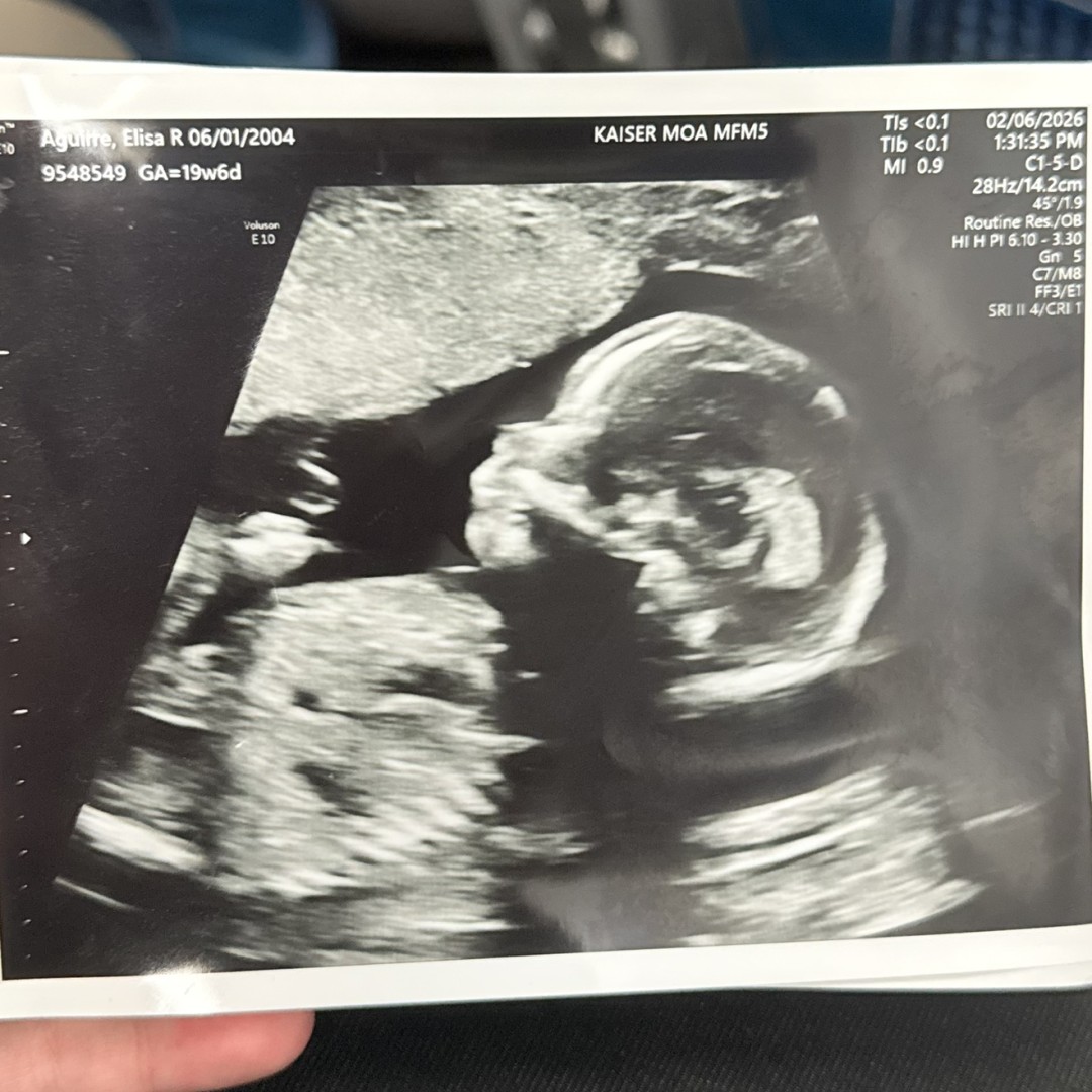 Photo shared by Elisa for their Babylist baby registry.