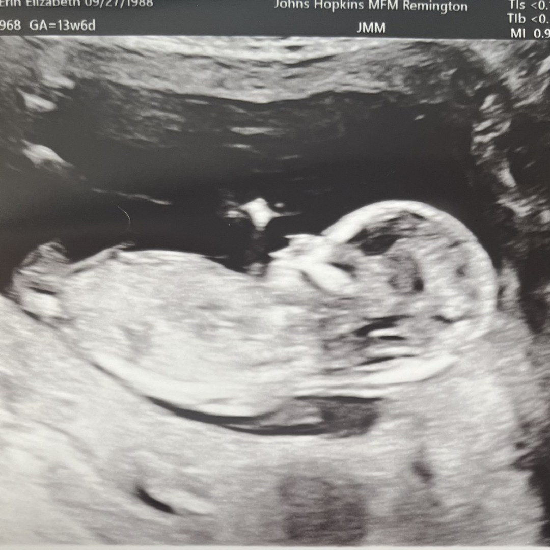 Photo shared by Erin for their Babylist baby registry.