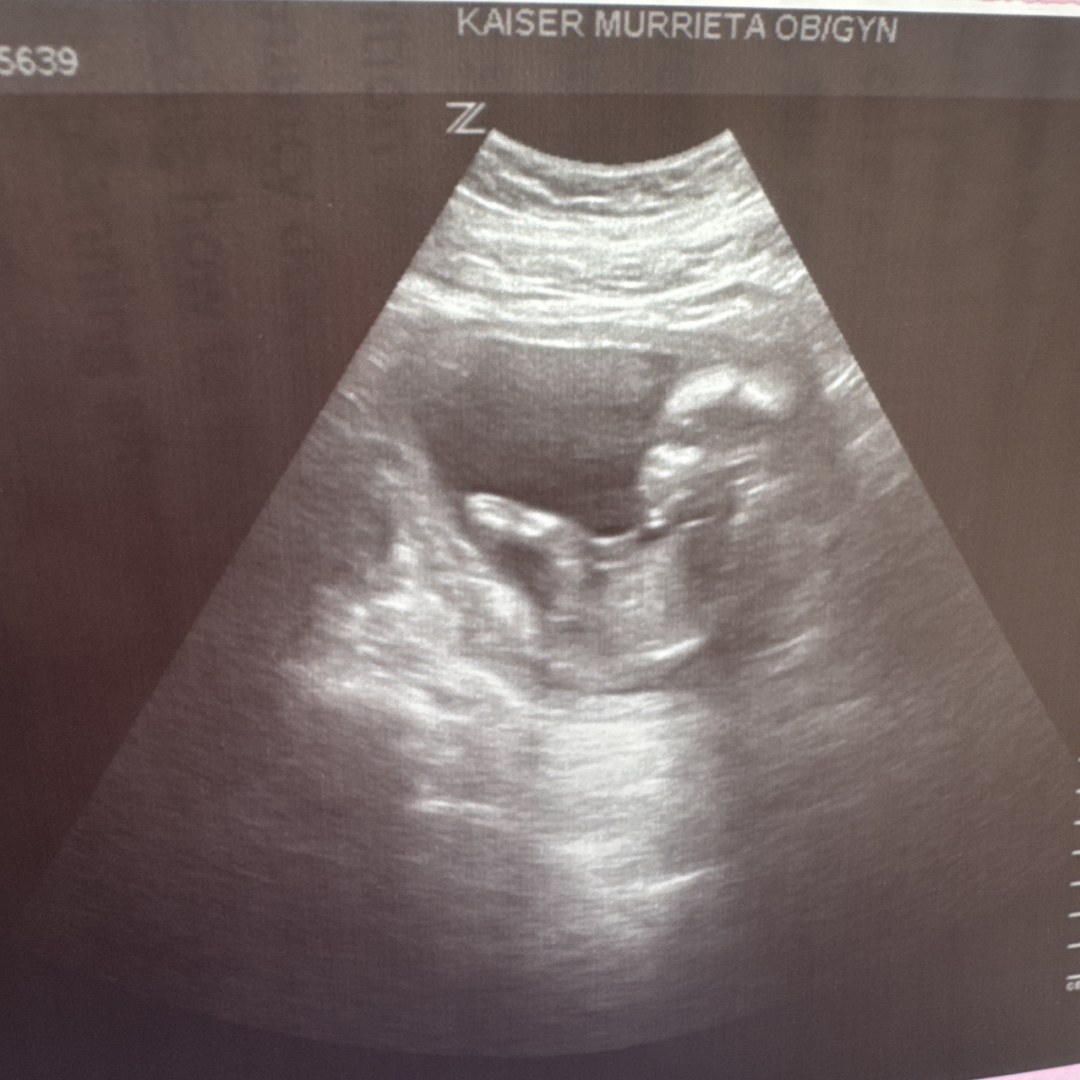 Photo shared by Ileana for their Babylist baby registry.