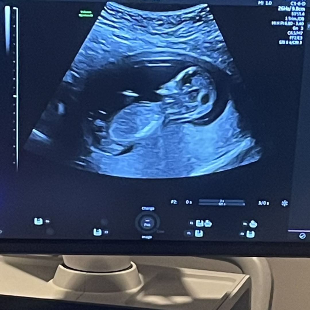 Photo shared by Dawn for their Babylist baby registry.