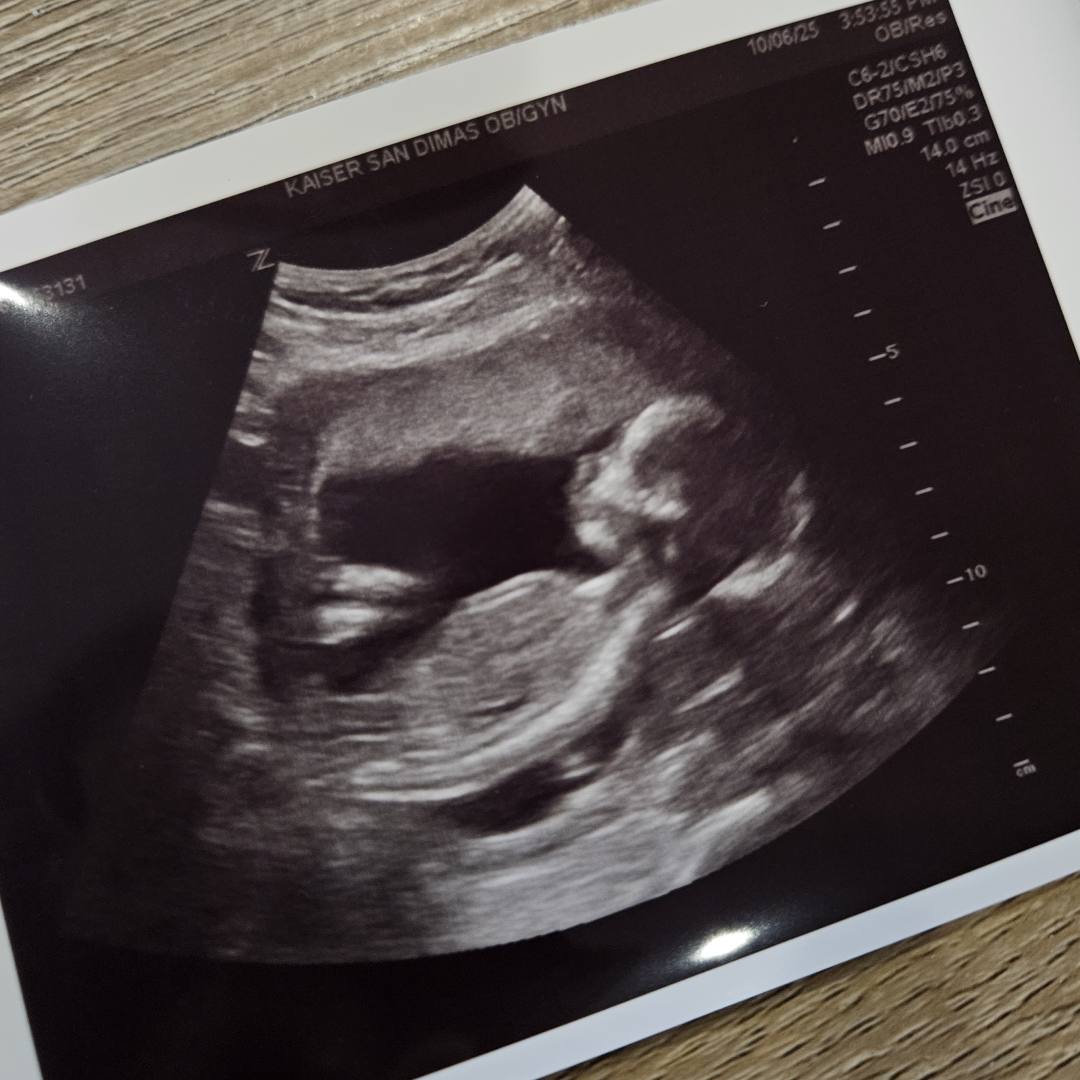 Photo shared by Sarah for their Babylist baby registry.