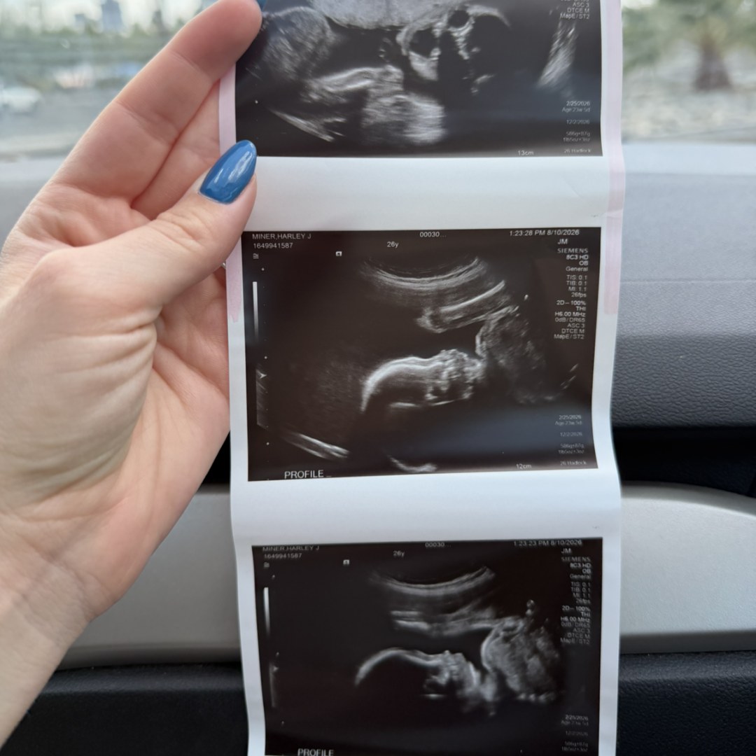 Photo shared by Harley for their Babylist baby registry.