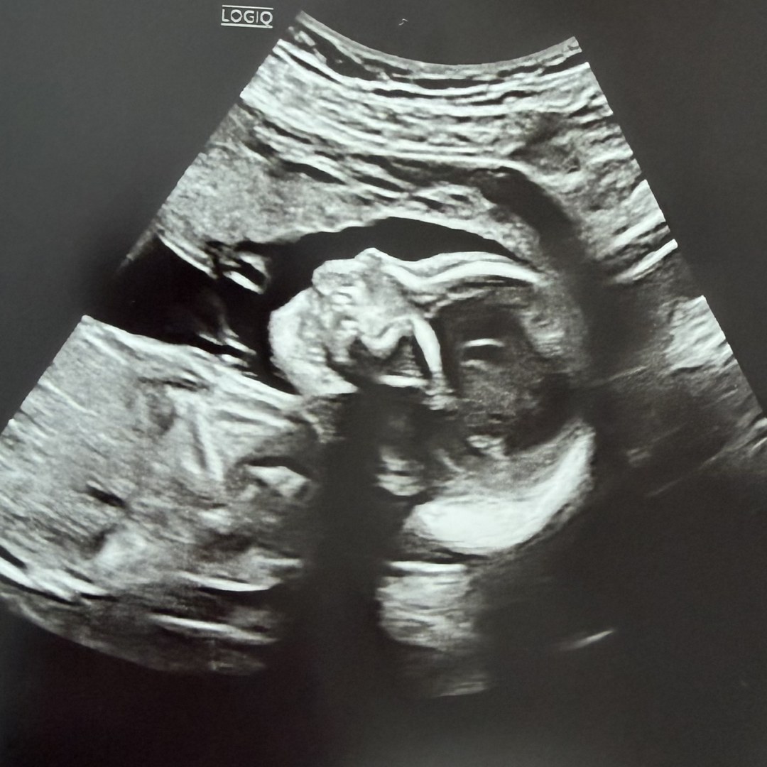 Photo shared by Mariah for their Babylist baby registry.