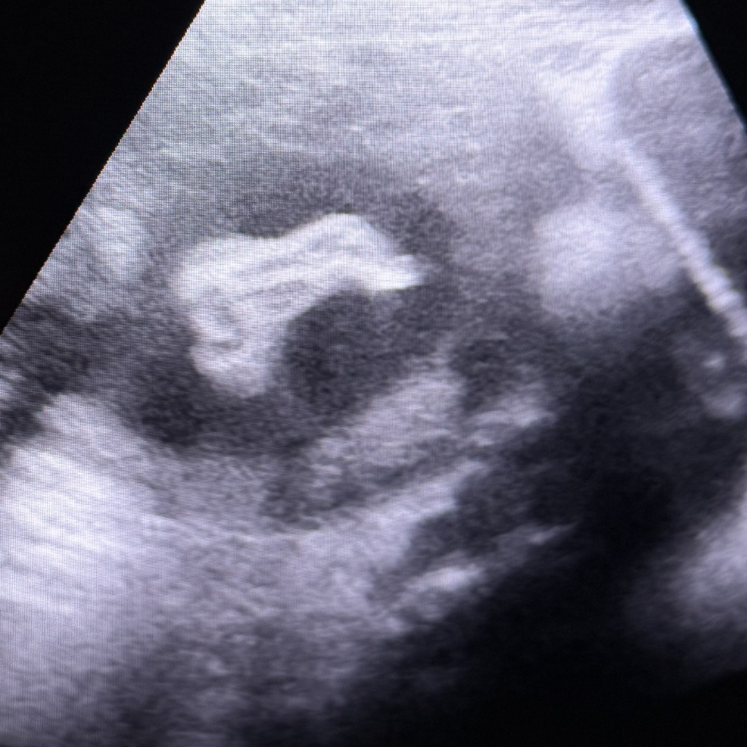Photo shared by Kelsey for their Babylist baby registry.