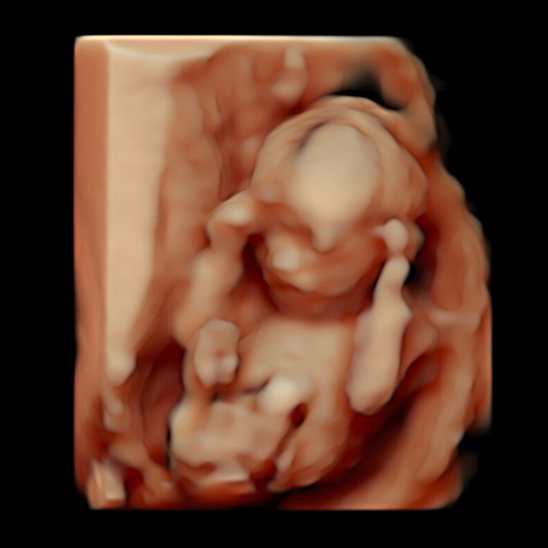 Photo shared by Chantel for their Babylist baby registry.