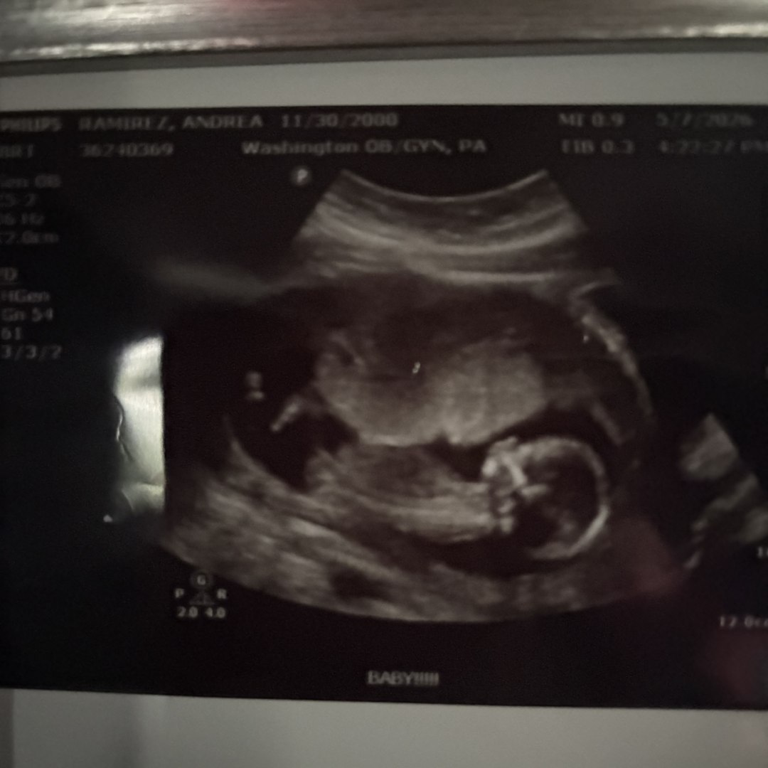 Photo shared by Andrea for their Babylist baby registry.