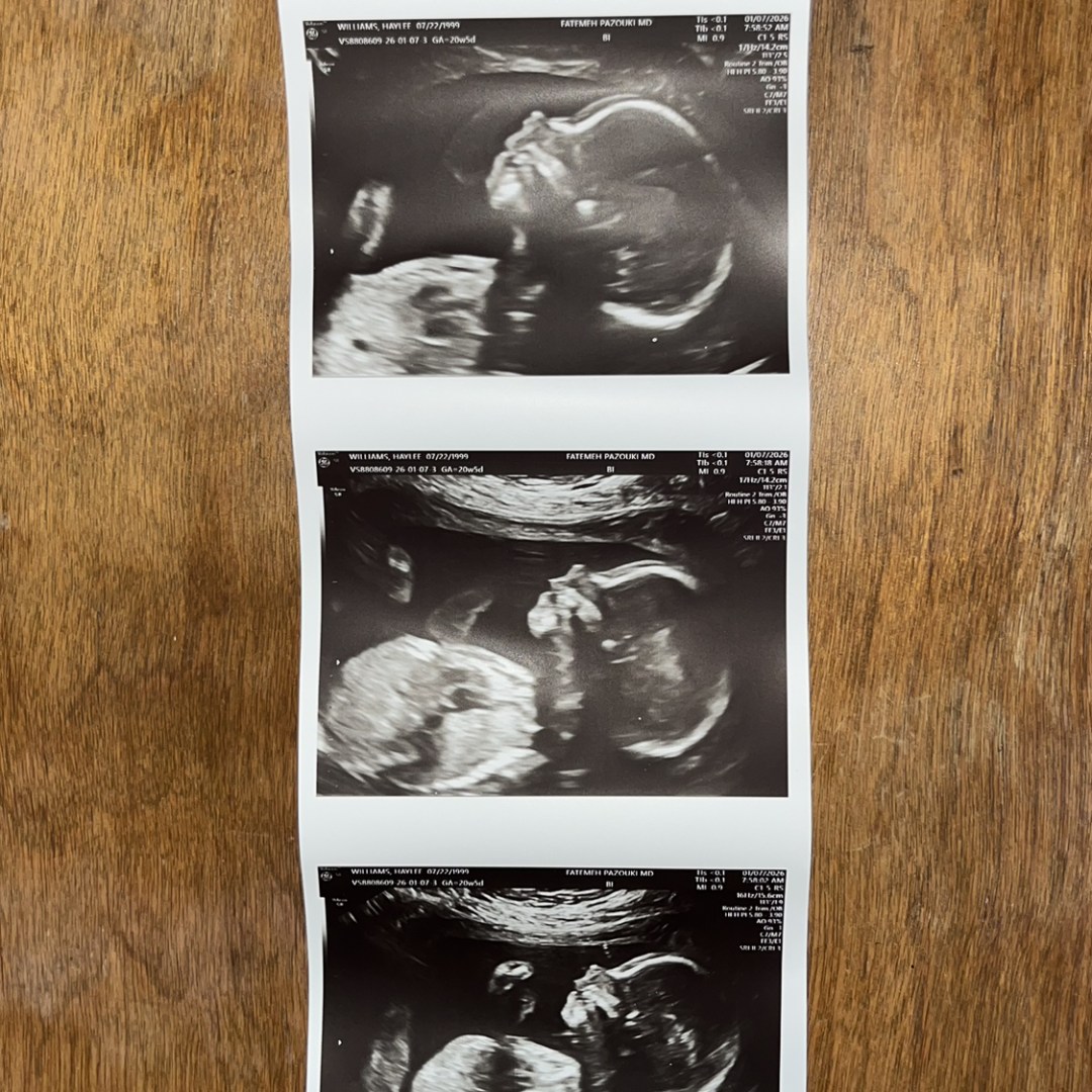 Photo shared by Haylee for their Babylist baby registry.