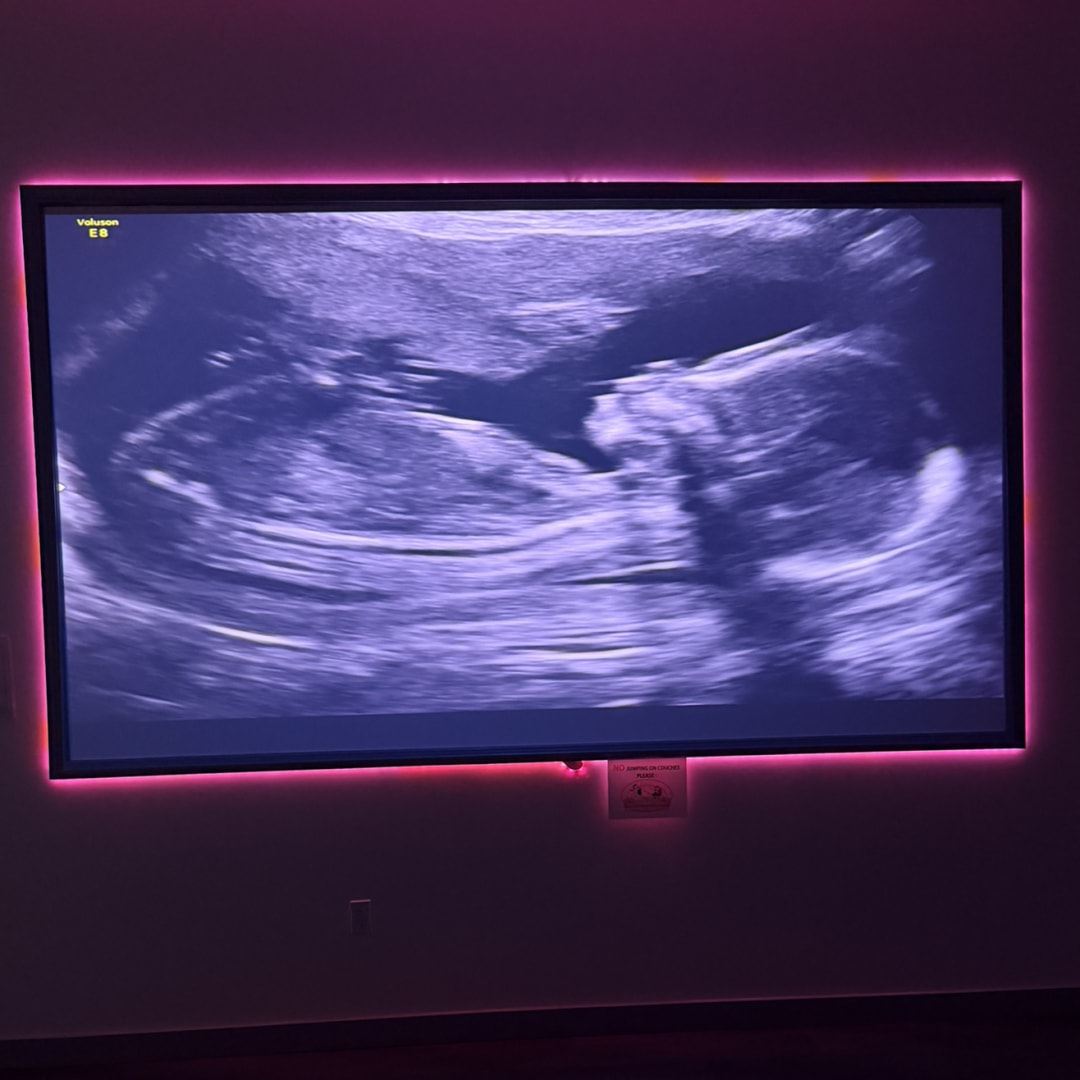 Photo shared by Angel for their Babylist baby registry.