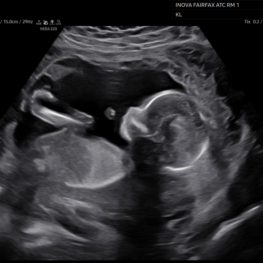 Photo shared by Christen for their Babylist baby registry.