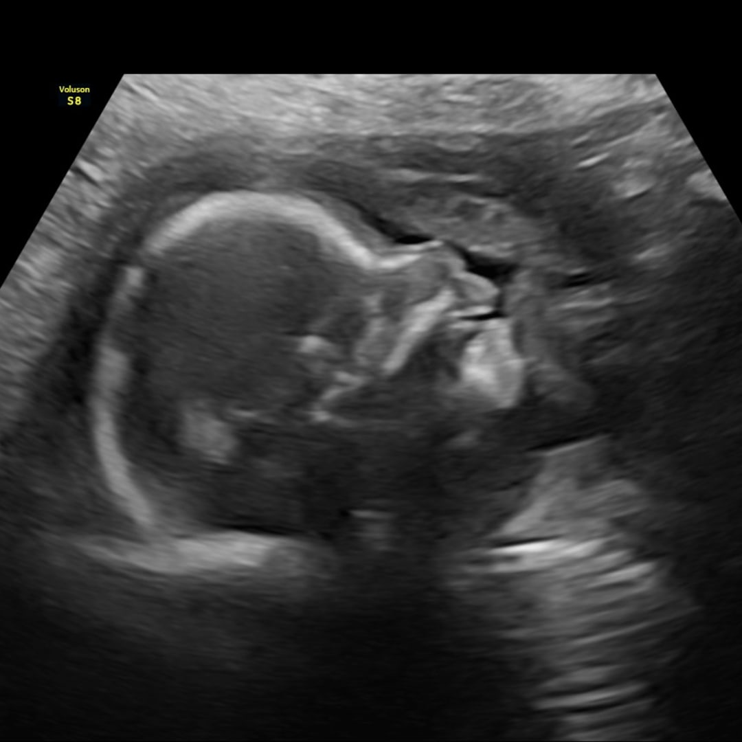 Photo shared by Mariana for their Babylist baby registry.