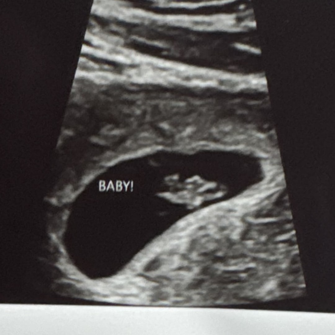 Photo shared by Darcey for their Babylist baby registry.