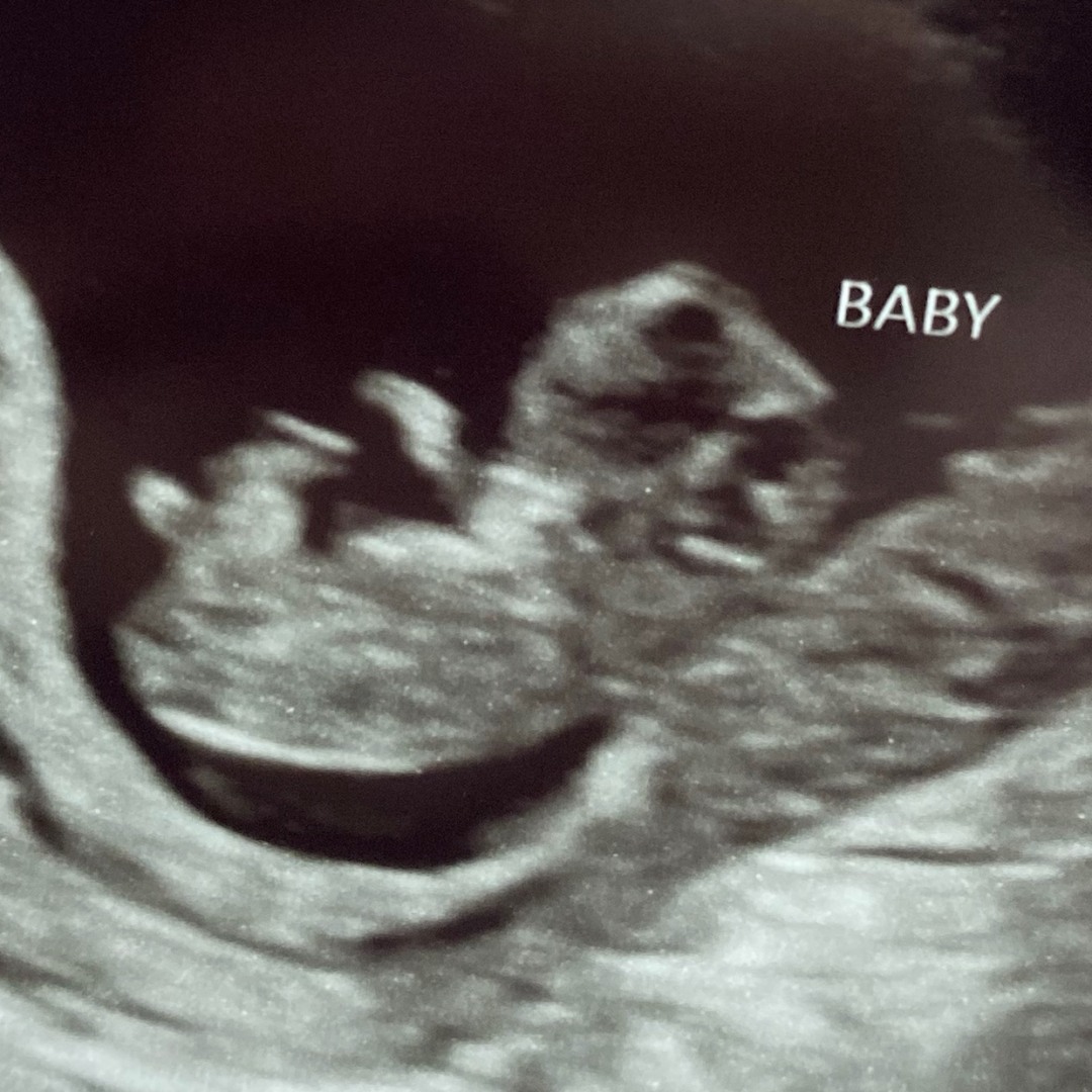 Photo shared by Jasmine for their Babylist baby registry.