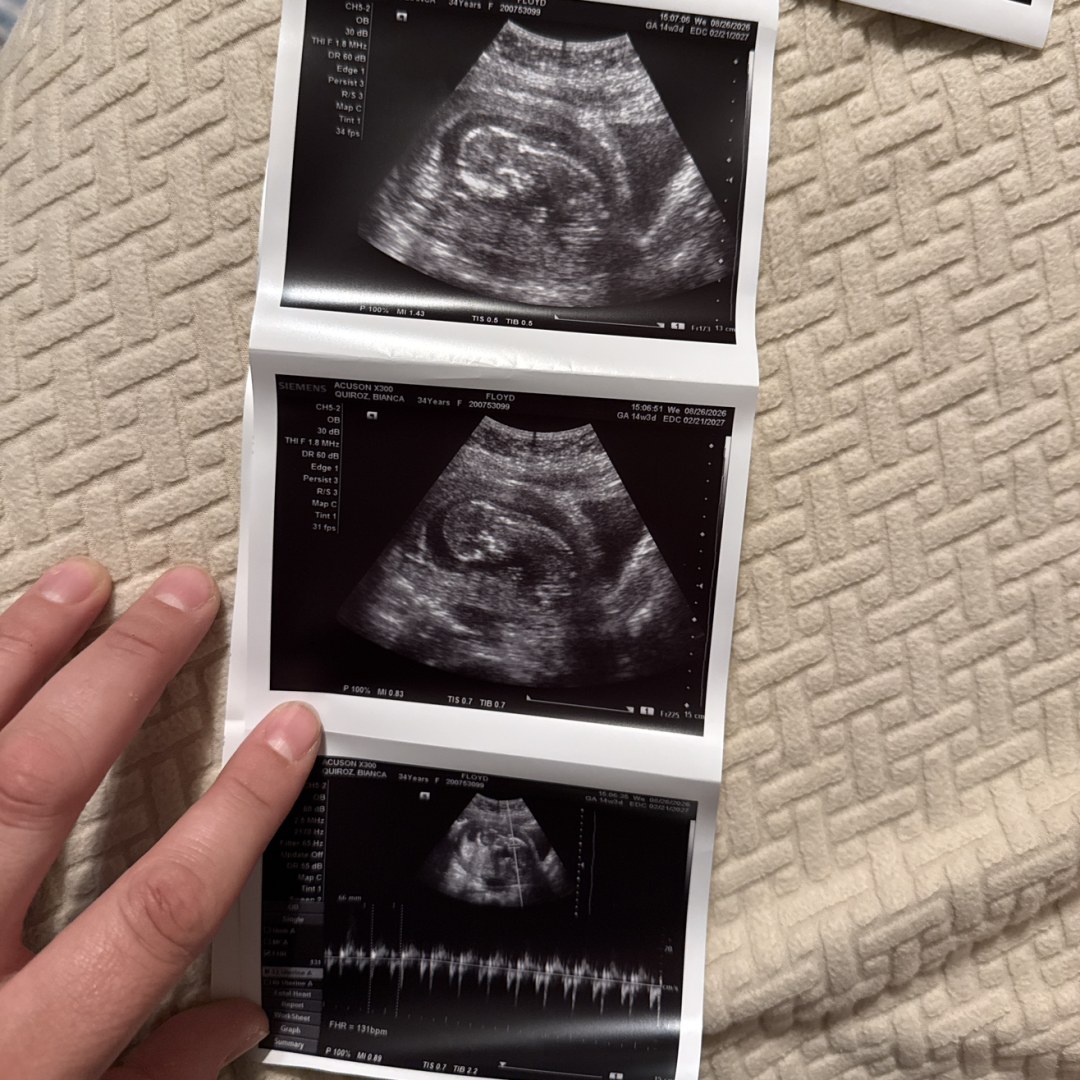 Photo shared by Bianca for their Babylist baby registry.
