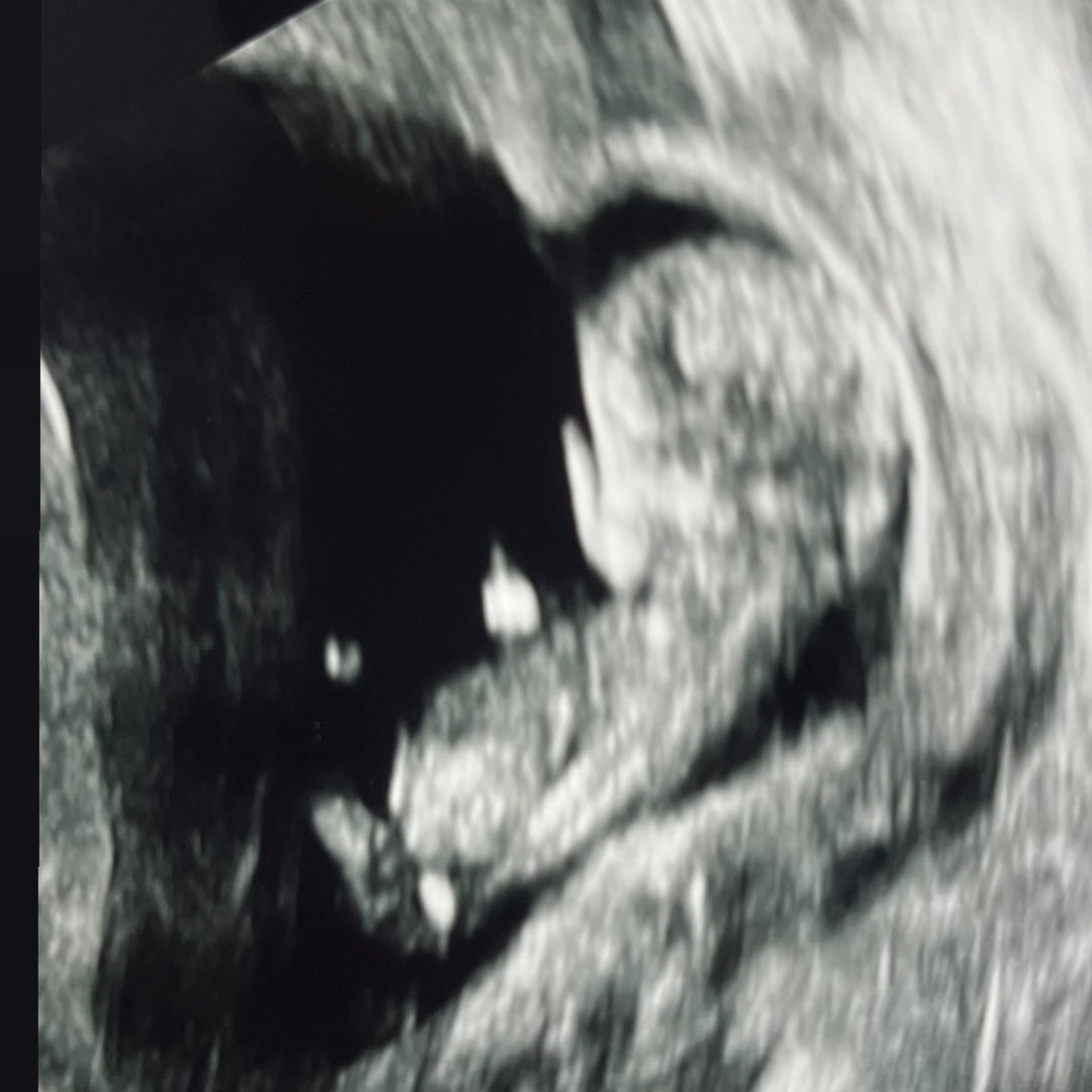 Photo shared by Megan for their Babylist baby registry.