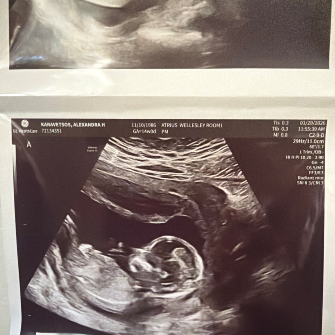 Photo shared by Sunny for their Babylist baby registry.