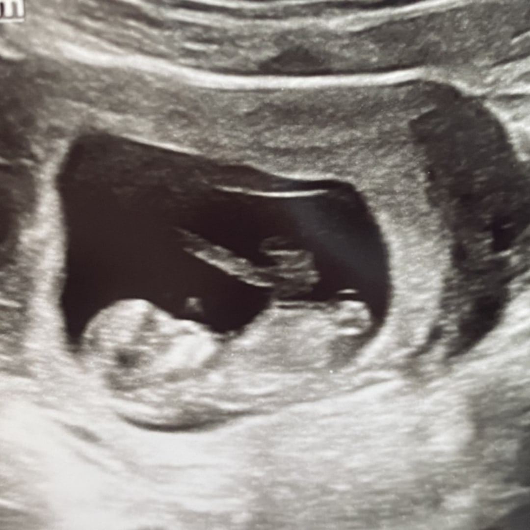 Photo shared by Celeste for their Babylist baby registry.