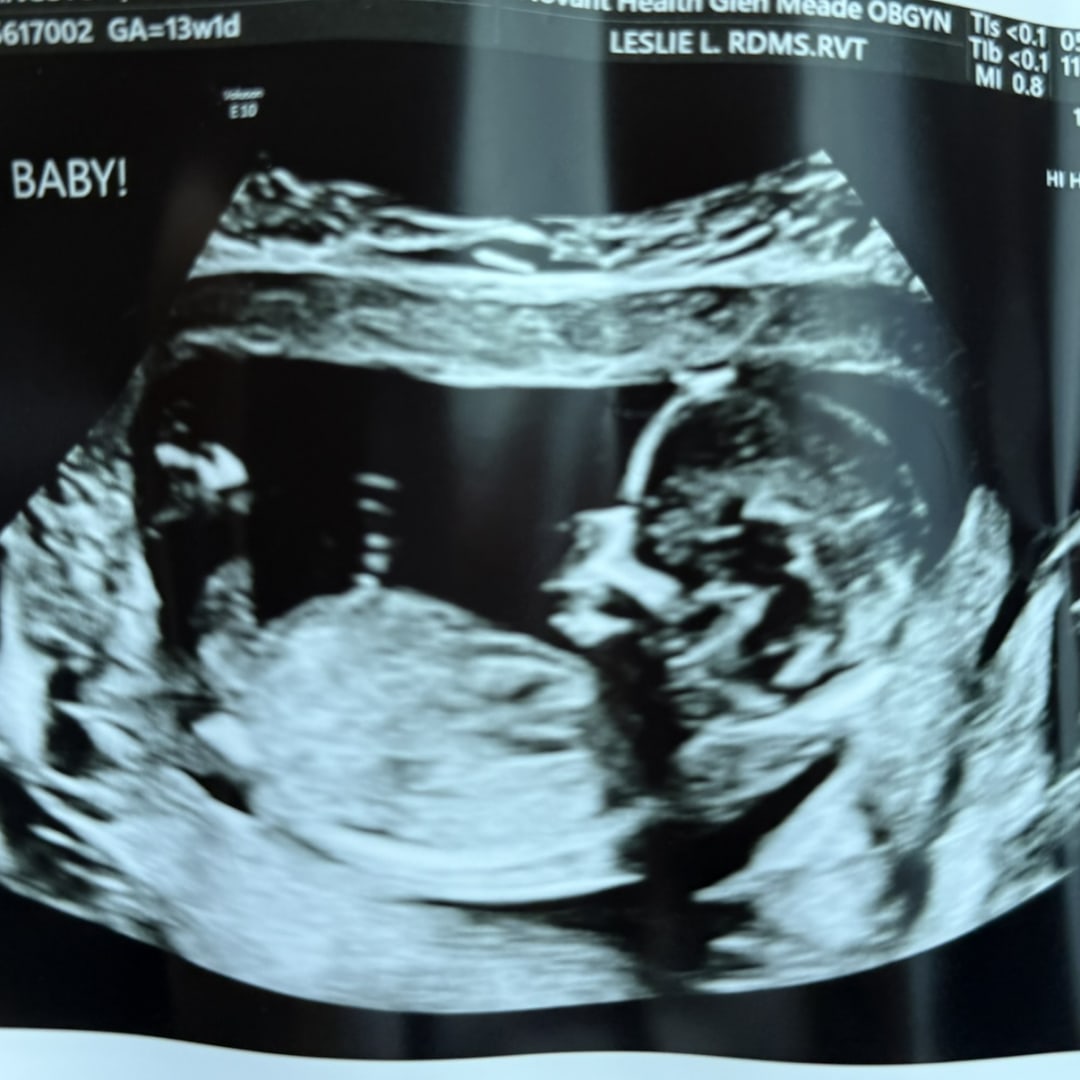 Photo shared by Sabrina for their Babylist baby registry.