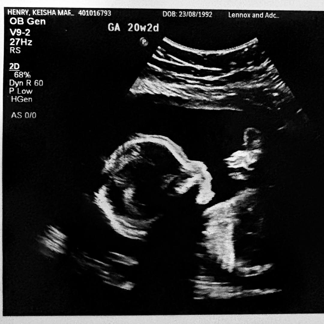 Photo shared by Keisha for their Babylist baby registry.
