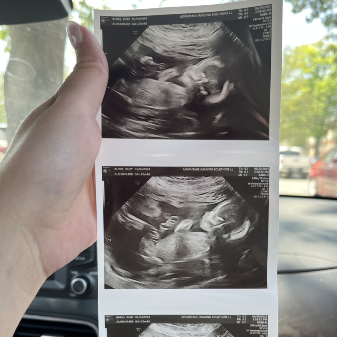 Photo shared by Ruby for their Babylist baby registry.