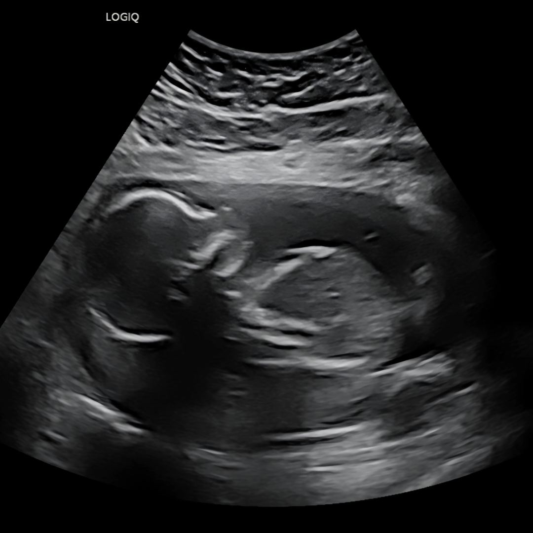 Photo shared by Alicia for their Babylist baby registry.