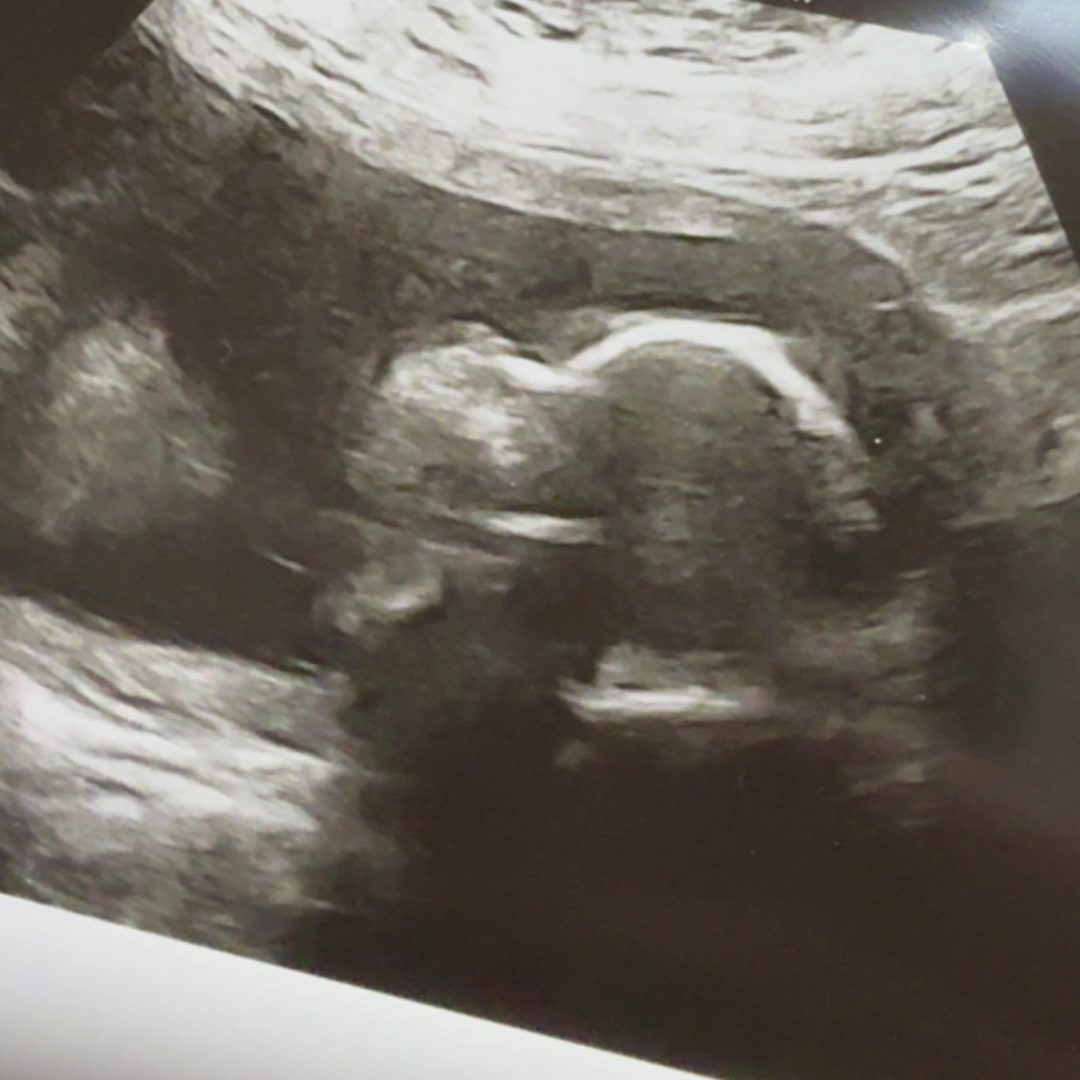 Photo shared by Schyler for their Babylist baby registry.