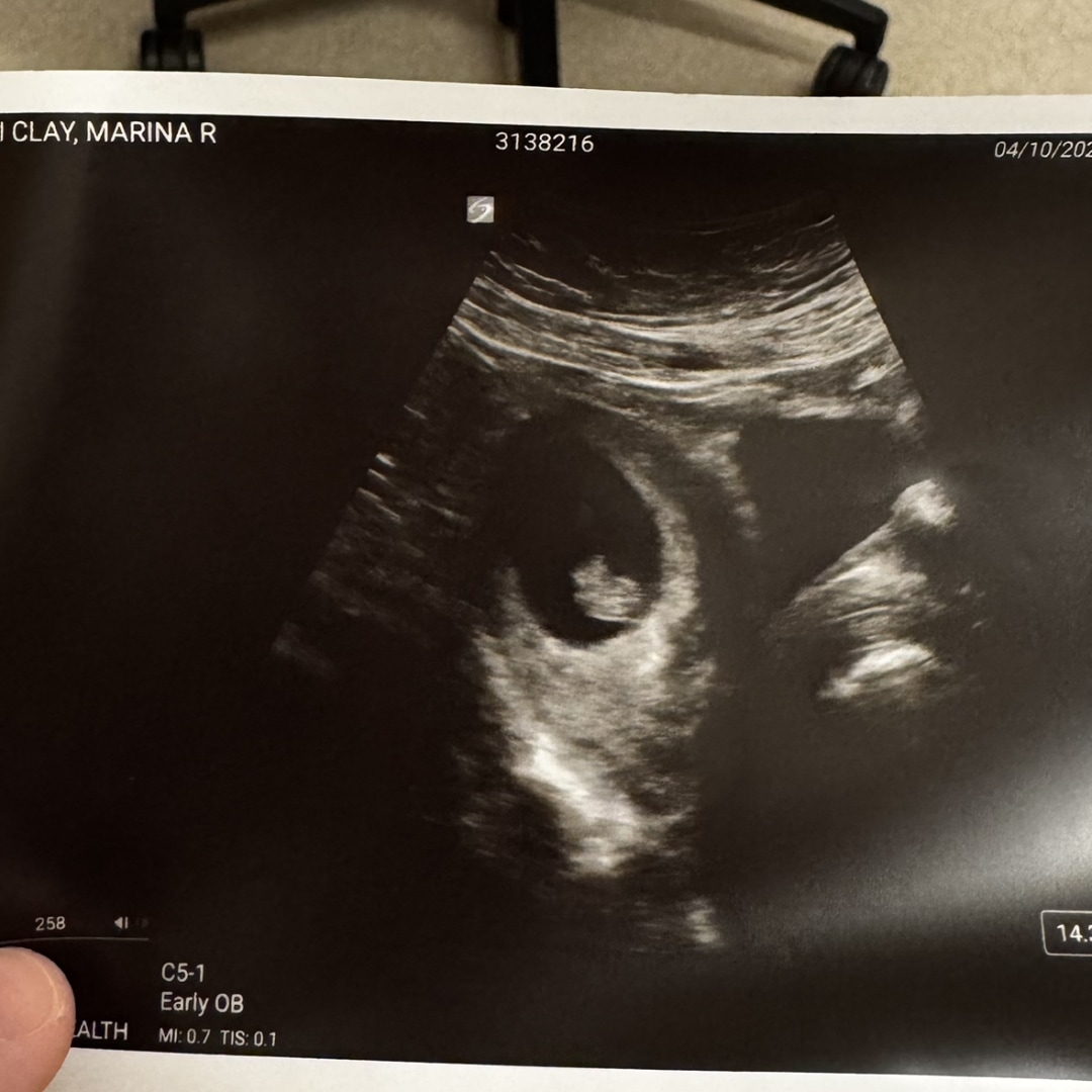 Photo shared by Marina for their Babylist baby registry.