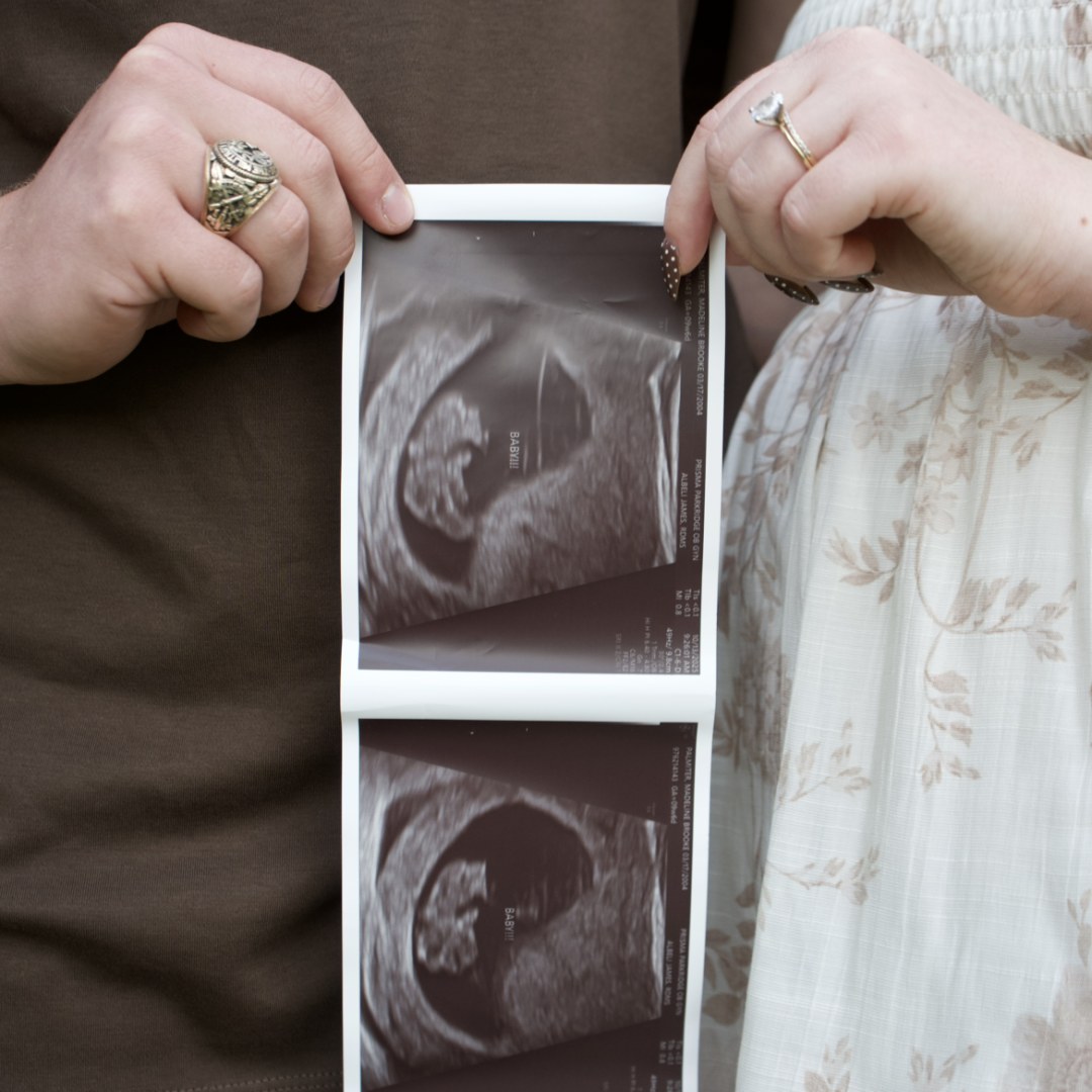 Photo shared by Madeline for their Babylist baby registry.