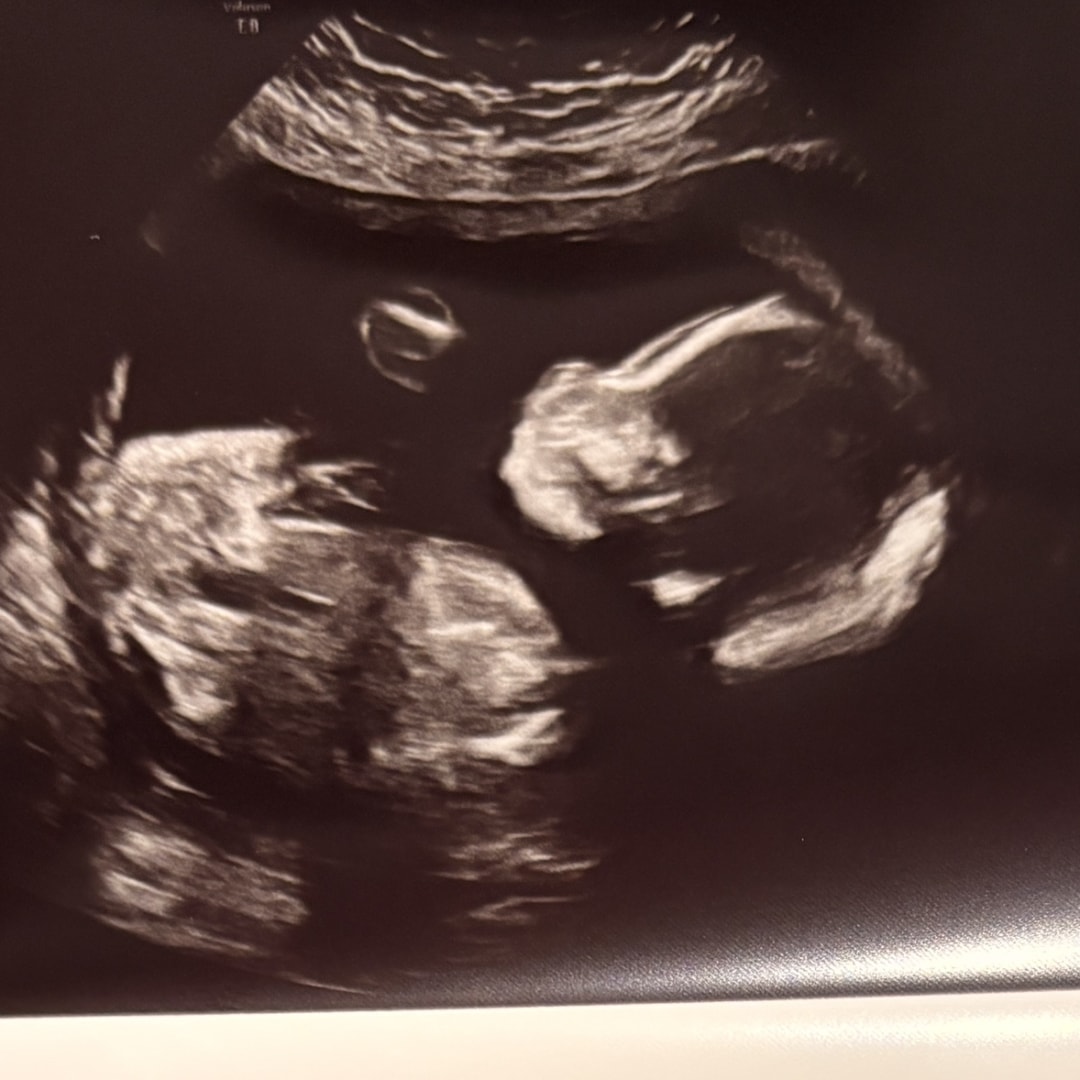 Photo shared by Carilou for their Babylist baby registry.