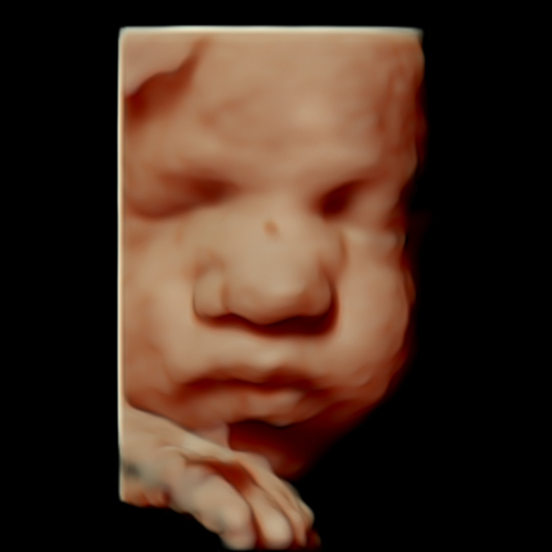 Photo shared by Caitlin for their Babylist baby registry.