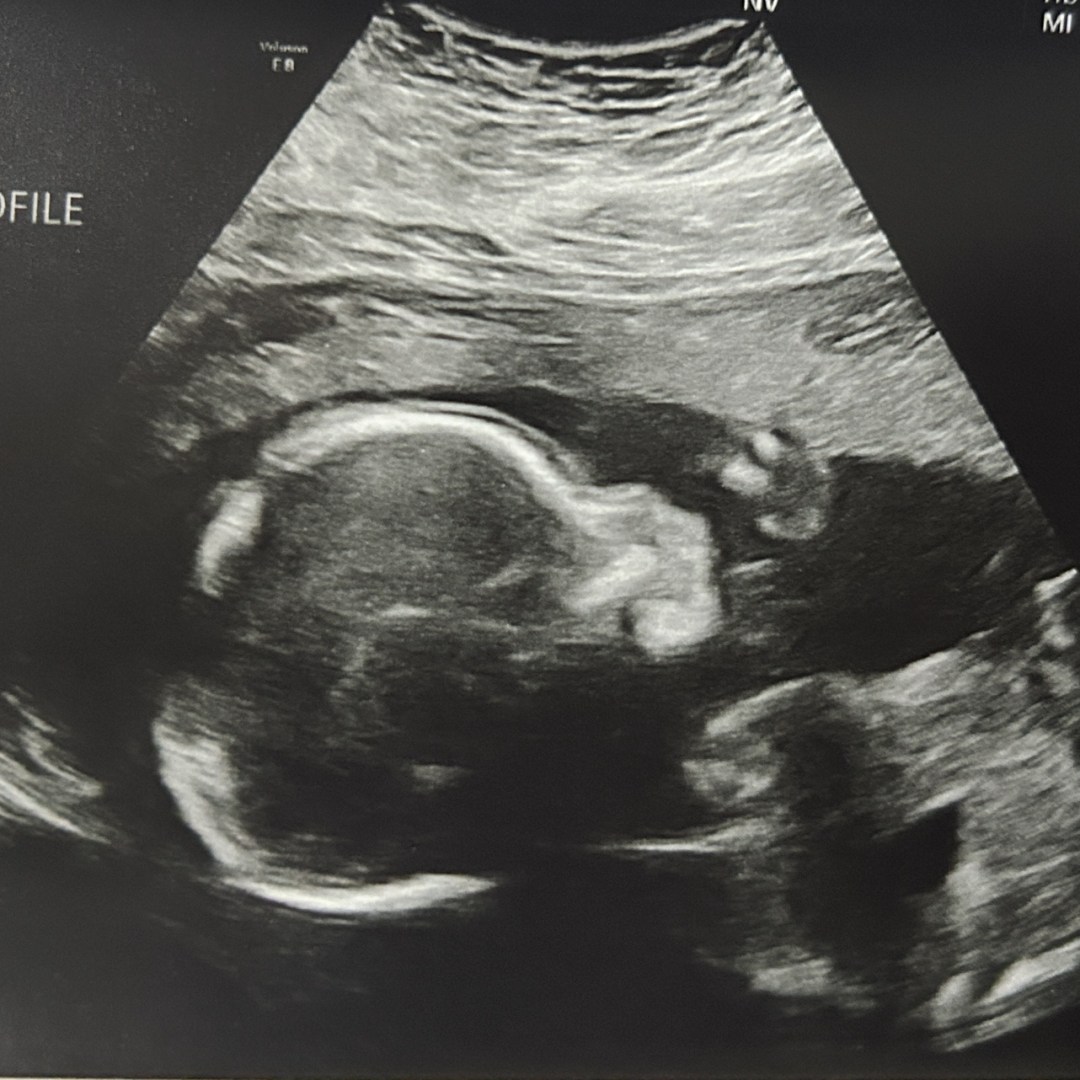 Photo shared by Asli for their Babylist baby registry.
