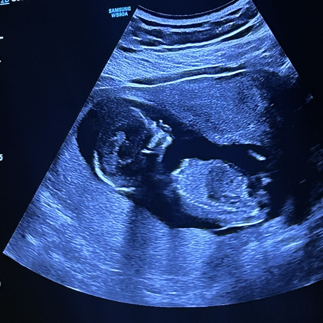 Photo shared by Dani for their Babylist baby registry.