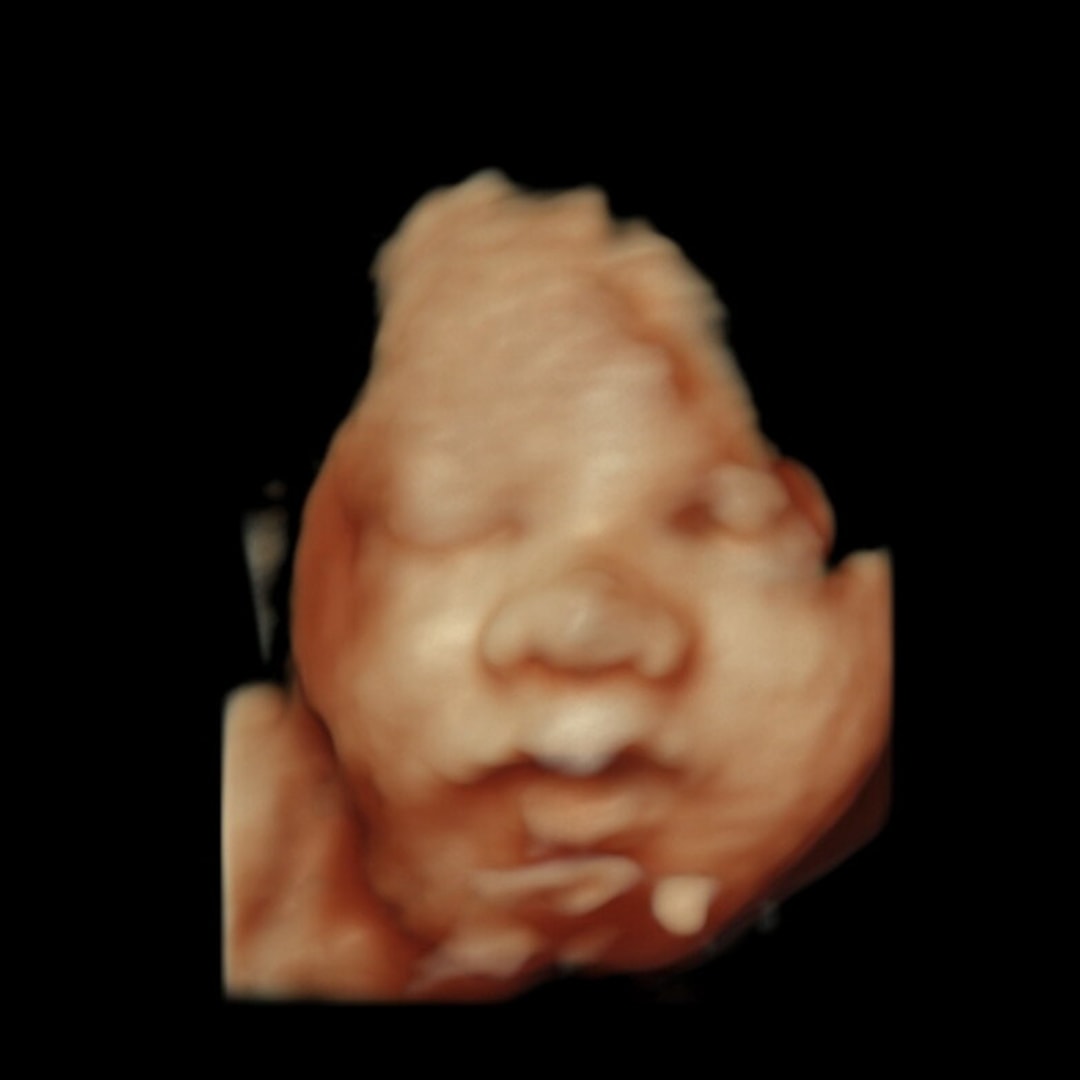 Photo shared by Stephanie for their Babylist baby registry.