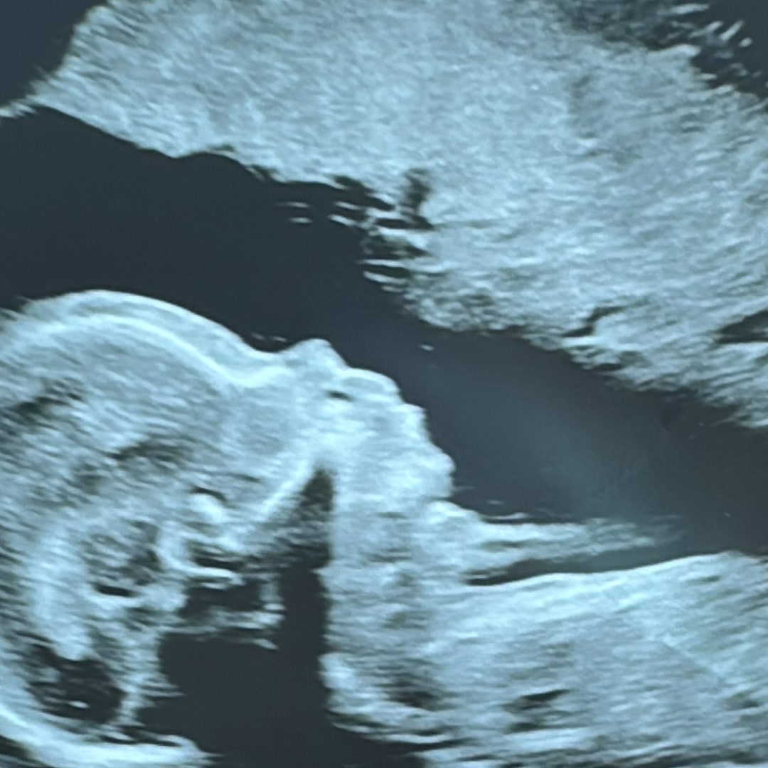 Photo shared by Jisela for their Babylist baby registry.