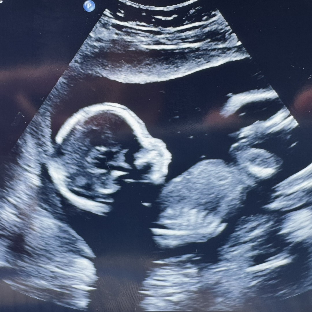 Photo shared by Brenda for their Babylist baby registry.