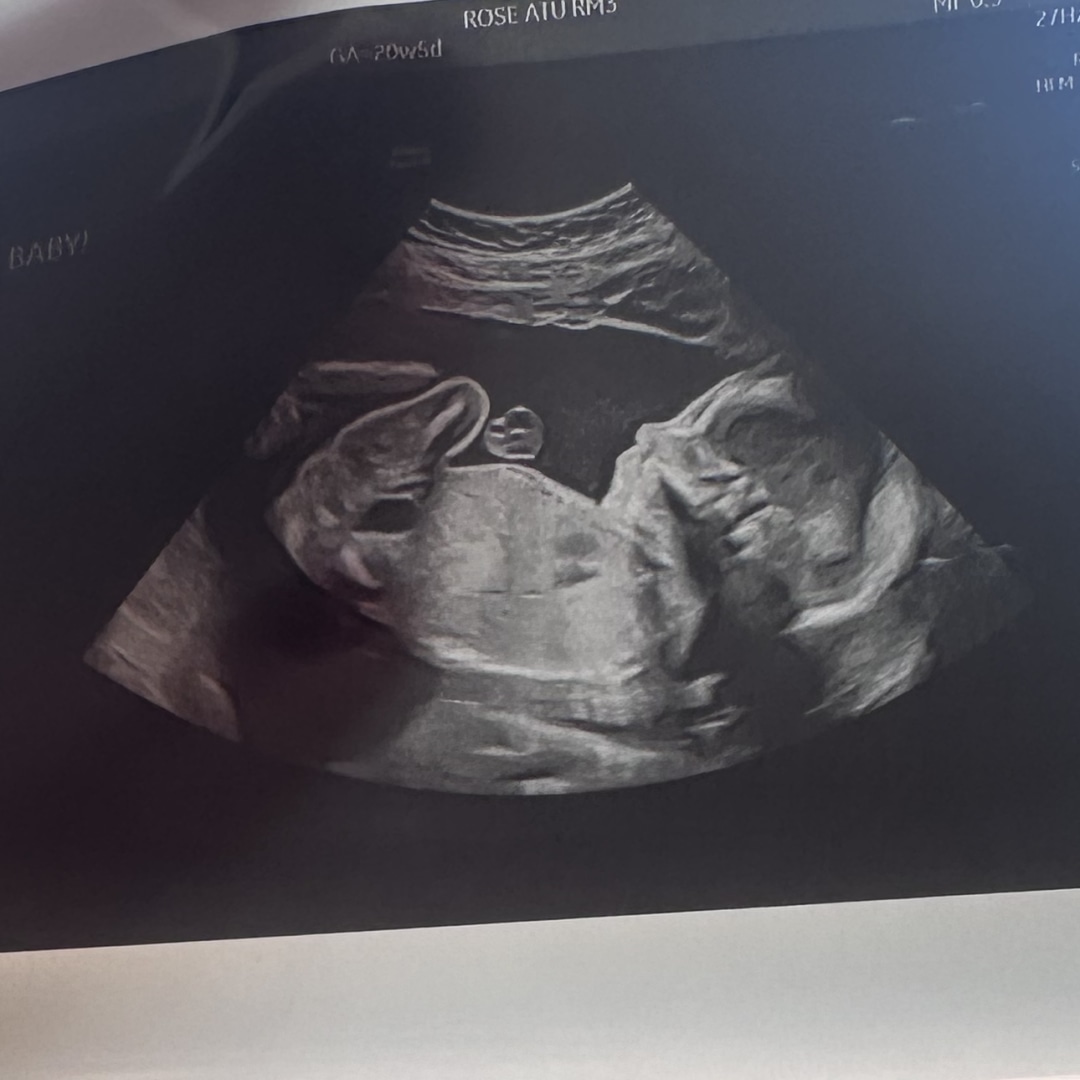 Photo shared by Courtney for their Babylist baby registry.