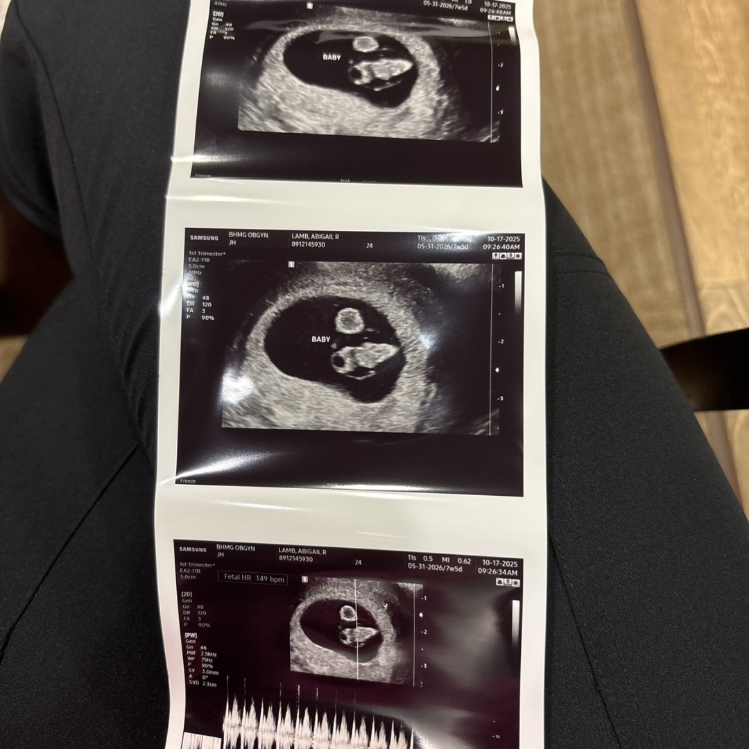 Photo shared by Abigail for their Babylist baby registry.