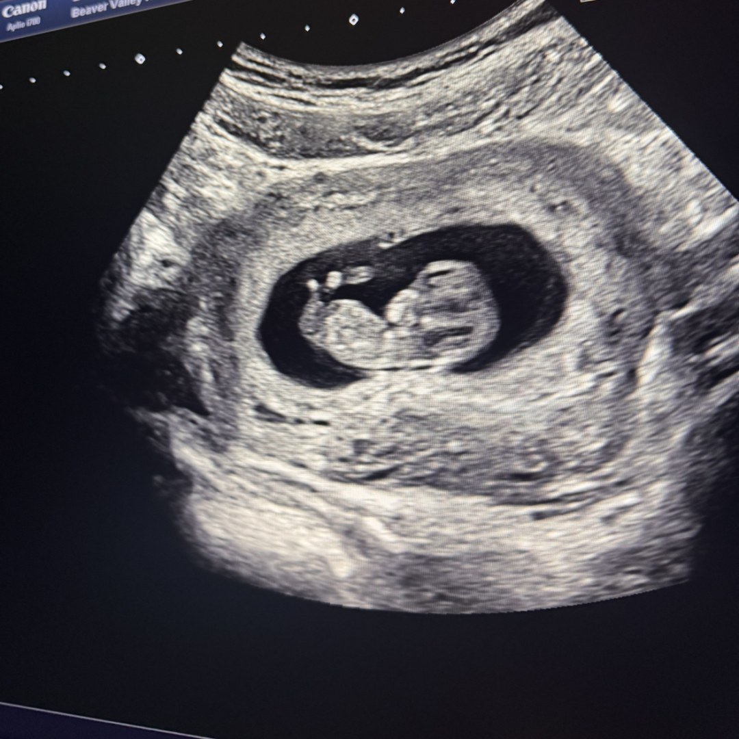 Photo shared by Alyssa for their Babylist baby registry.