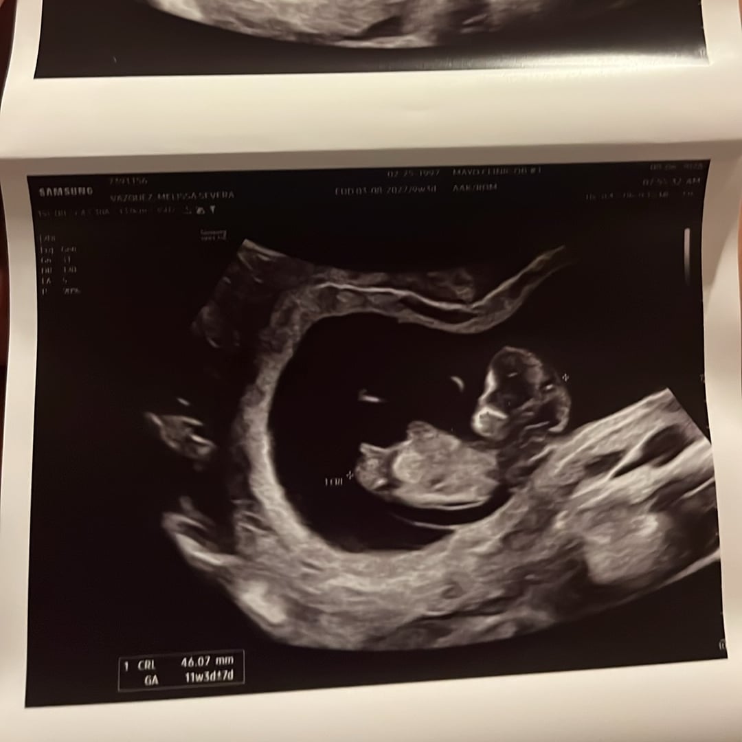Photo shared by Melissa for their Babylist baby registry.