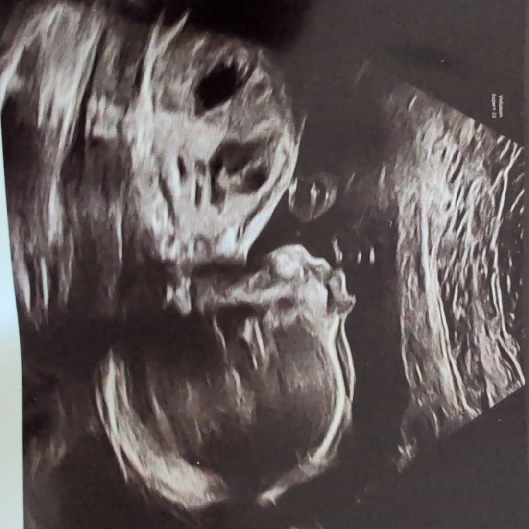 Photo shared by Hannah for their Babylist baby registry.