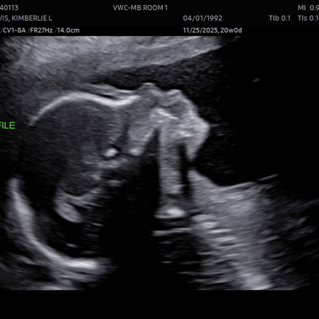 Photo shared by Kimberlie for their Babylist baby registry.