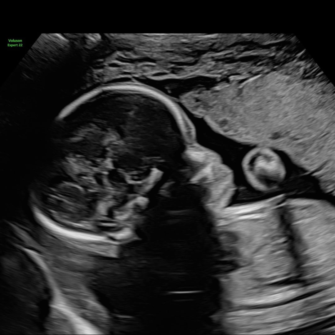 Photo shared by Ebony for their Babylist baby registry.