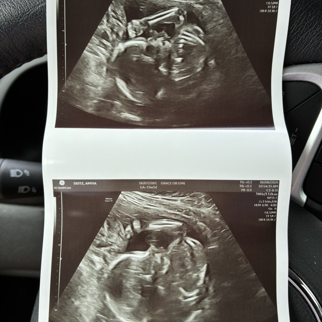 Photo shared by Amyia for their Babylist baby registry.