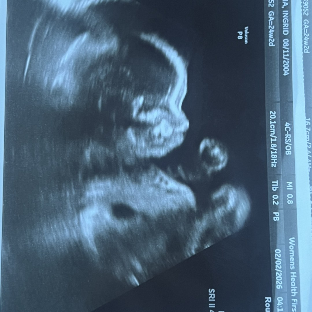 Photo shared by Erik for their Babylist baby registry.