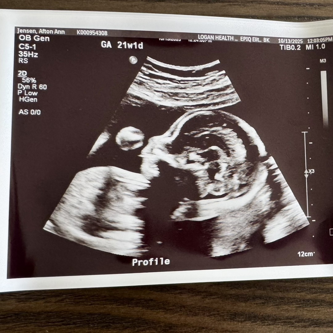 Photo shared by Afton for their Babylist baby registry.