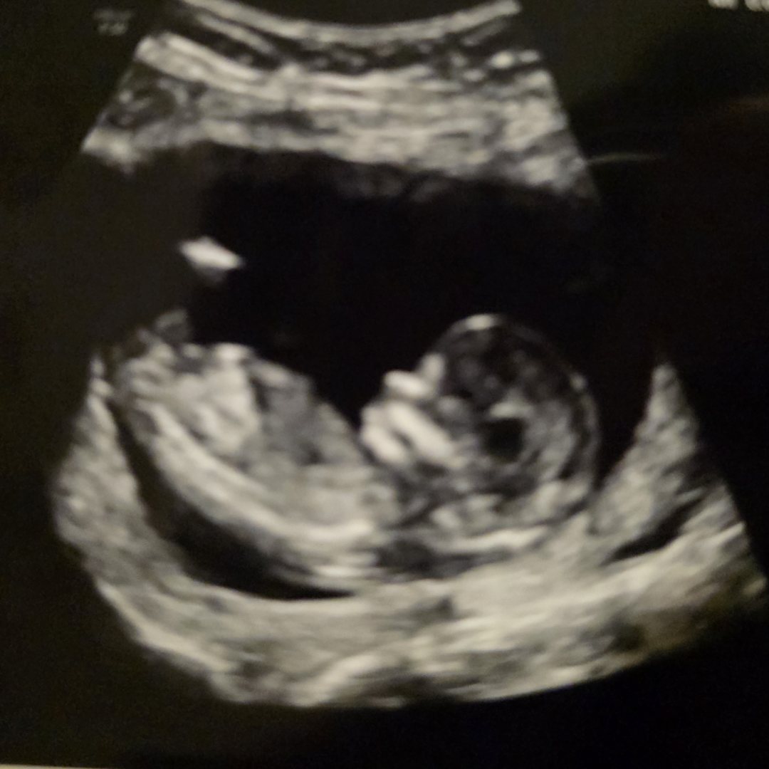 Photo shared by Shannon for their Babylist baby registry.