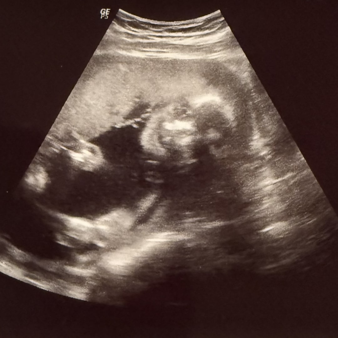 Photo shared by Audrey for their Babylist baby registry.