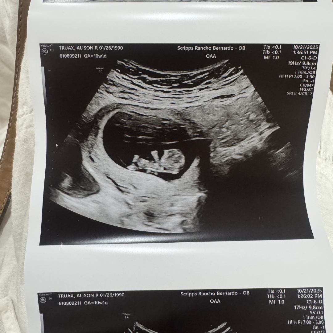 Photo shared by Alison for their Babylist baby registry.