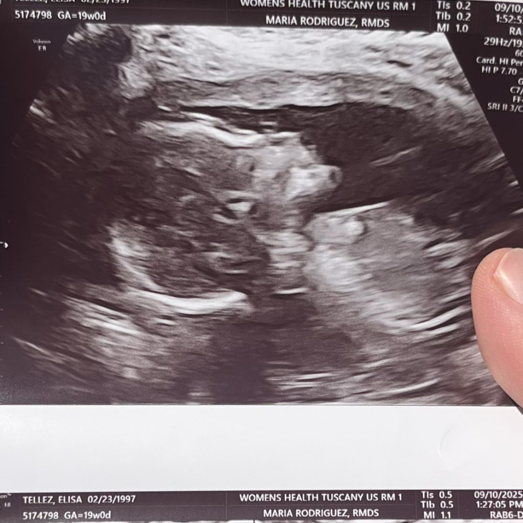 Photo shared by Elisa for their Babylist baby registry.