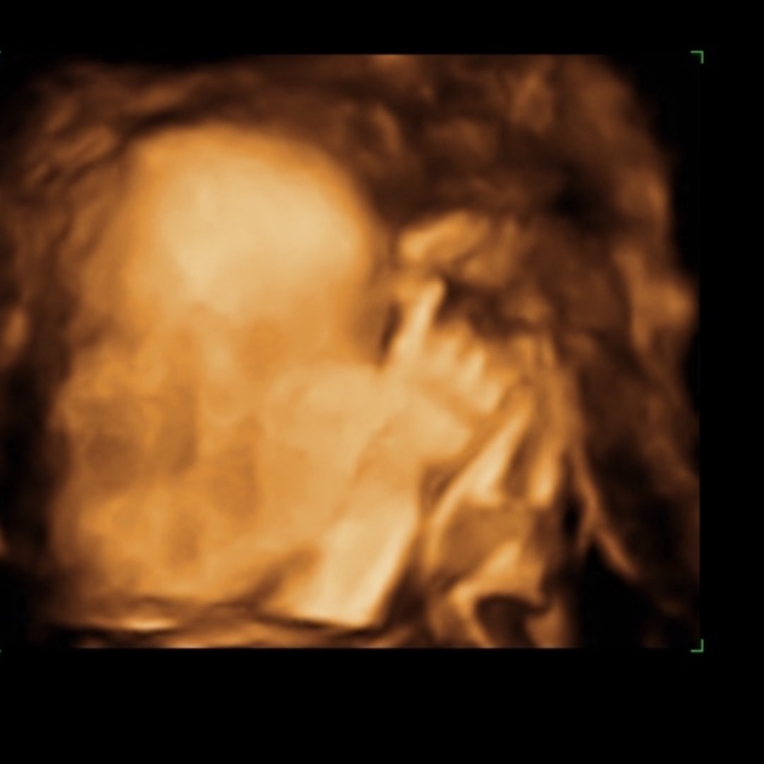 Photo shared by Stefany for their Babylist baby registry.